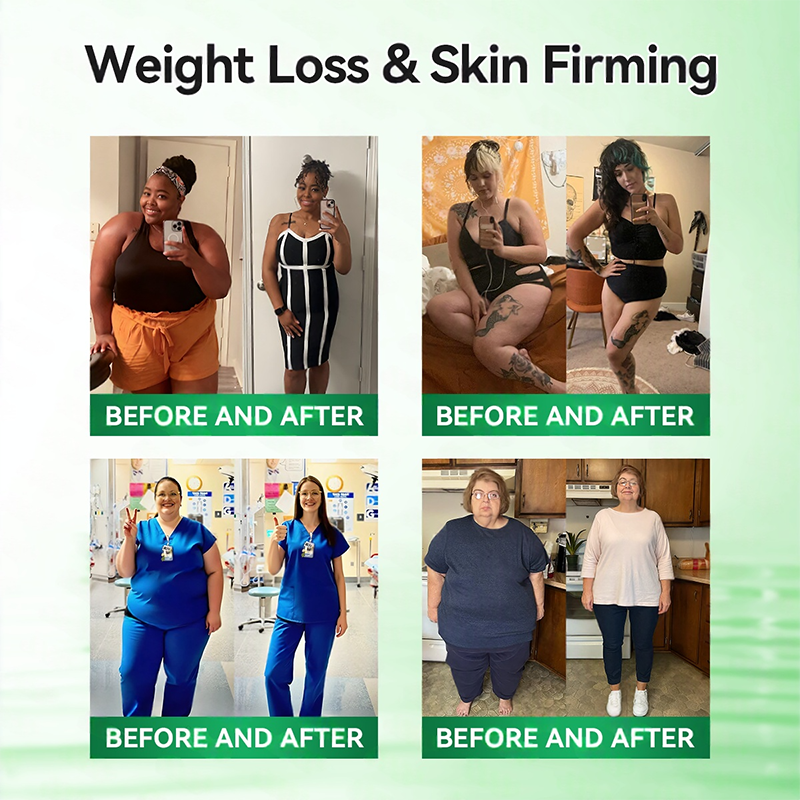 𝑶𝒇𝒇𝒊𝒄𝒊𝒂𝒍 𝑺𝒕𝒐𝒓𝒆  | 👩‍⚕️ H𝐞a𝐥r𝐢z𝐞® 1𝟐-𝐈N-1 M𝐨r𝐢n𝐠a * B𝐞r𝐛e𝐫i𝐧e * N𝐀D+ 𝐀d𝐯a𝐧c𝐞d N𝐚n𝐨 𝐌i𝐜r𝐨n𝐞e𝐝l𝐞 𝐏a𝐭c𝐡 (𝐎𝐧𝐜𝐞 𝐃𝐚𝐢𝐥𝐲, 𝐯𝐢𝐬𝐢𝐛𝐥𝐞 𝐜𝐡𝐚𝐧𝐠𝐞𝐬 𝐢𝐧 𝟕 𝐝𝐚𝐲𝐬）🔥F𝐨r 𝐎𝐛𝐞𝐬𝐢𝐭𝐲, 𝐋o𝐨s𝐞 𝐒k𝐢n, 𝐃𝐢𝐚𝐛𝐞𝐭𝐞𝐬, 𝐒𝐥𝐞𝐞𝐩 𝐀𝐩𝐧𝐞𝐚, 𝐀𝐧𝐝 𝐉𝐨𝐢𝐧𝐭 𝐈𝐬𝐬𝐮𝐞𝐬🌽